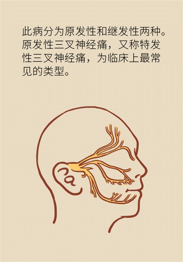這種疼痛不是牙疼？緩解三叉神經(jīng)痛就用這兩招