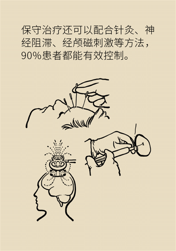 這種疼痛不是牙疼？緩解三叉神經(jīng)痛就用這兩招