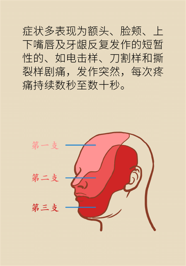 這種疼痛不是牙疼？緩解三叉神經(jīng)痛就用這兩招