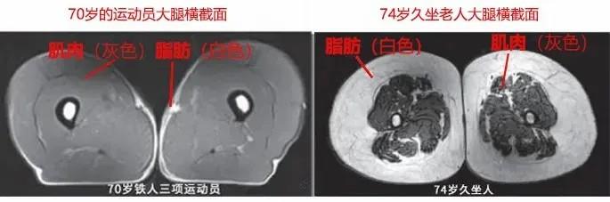 運(yùn)動(dòng)是加速衰老，還是延緩衰老？真相揭開