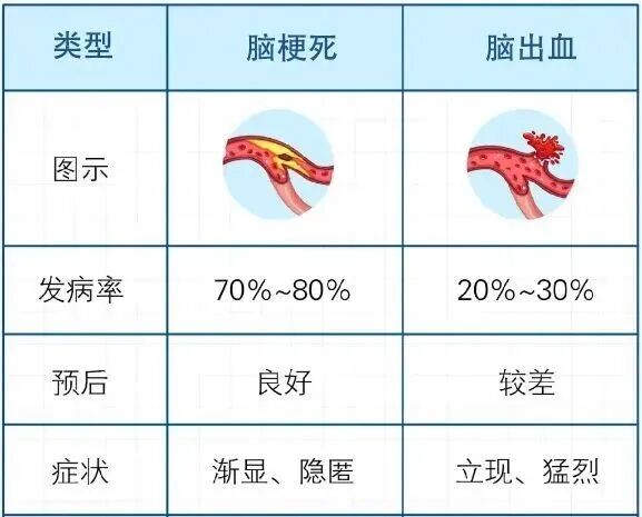 腦梗高發(fā)季到了！有3種不舒服，千萬別大意